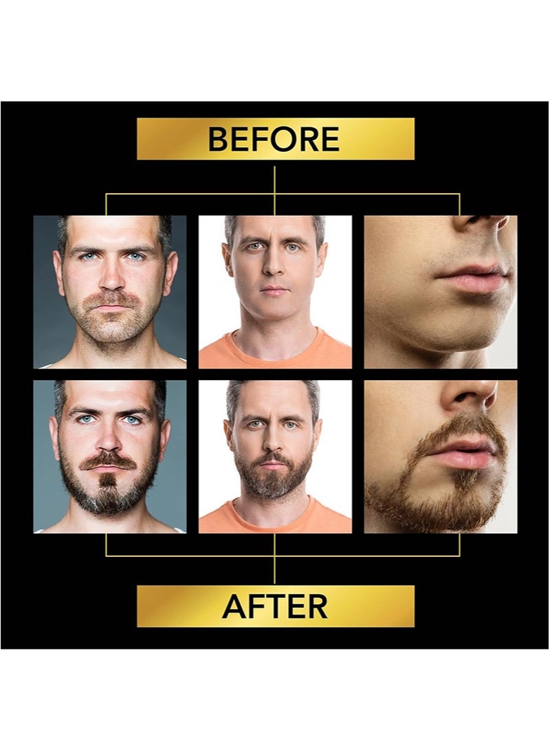 Sefudun Beard Growth Kit - Beard Roller and Beard Growth Serum - Biotin Beard Growth Oil for Promote Hair Regrowth - Beard Serum for Facial Hair Treatment Masculine Thick,2 Fl Oz - Image 4