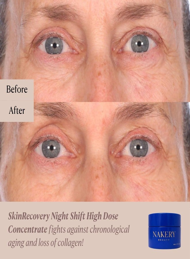 Nakery Night Shift Overnight Face Cream, Retinol Sleep Repair Cream with Methylene Blue, NAD+, and Melatonin, Anti-Aging Night Moisturizer for Fine Lines, Collagen Boost, and Cellular Renewal - Image 5