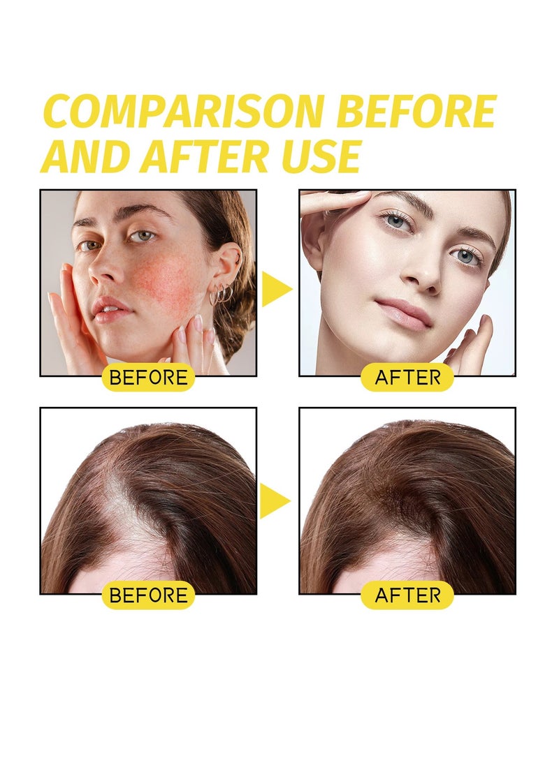 EELHOE Organic Black Seed Oil, Cold Pressed Black Seed Oil for Hair, Black Seed Oil Drops for Face, Natural Black Seed Oil, Black Currant Seed Oil, Black Cumin Seed Oil, Black Seed Oil for Skin 60ml - Image 5