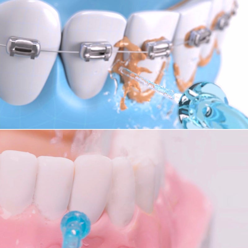 SOOCAS Oral Irrigator IPX7 Waterproof Adjustable 3 Modes Simple Operation - Constant Pressure Stable Water Pulse Dental Flosser for Oral Care - Image 5
