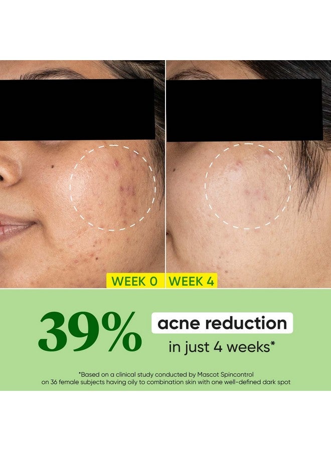 Dot & Key Dot & Key CICA Calming Skin Renewing Night Gel | For Oily, Acne Prone And Sensitive Skin | Night Cream with Niacinamide, Green Tea & Hyaluronic | Fades Blemishes & Dark Spots | 60ml - Image 3