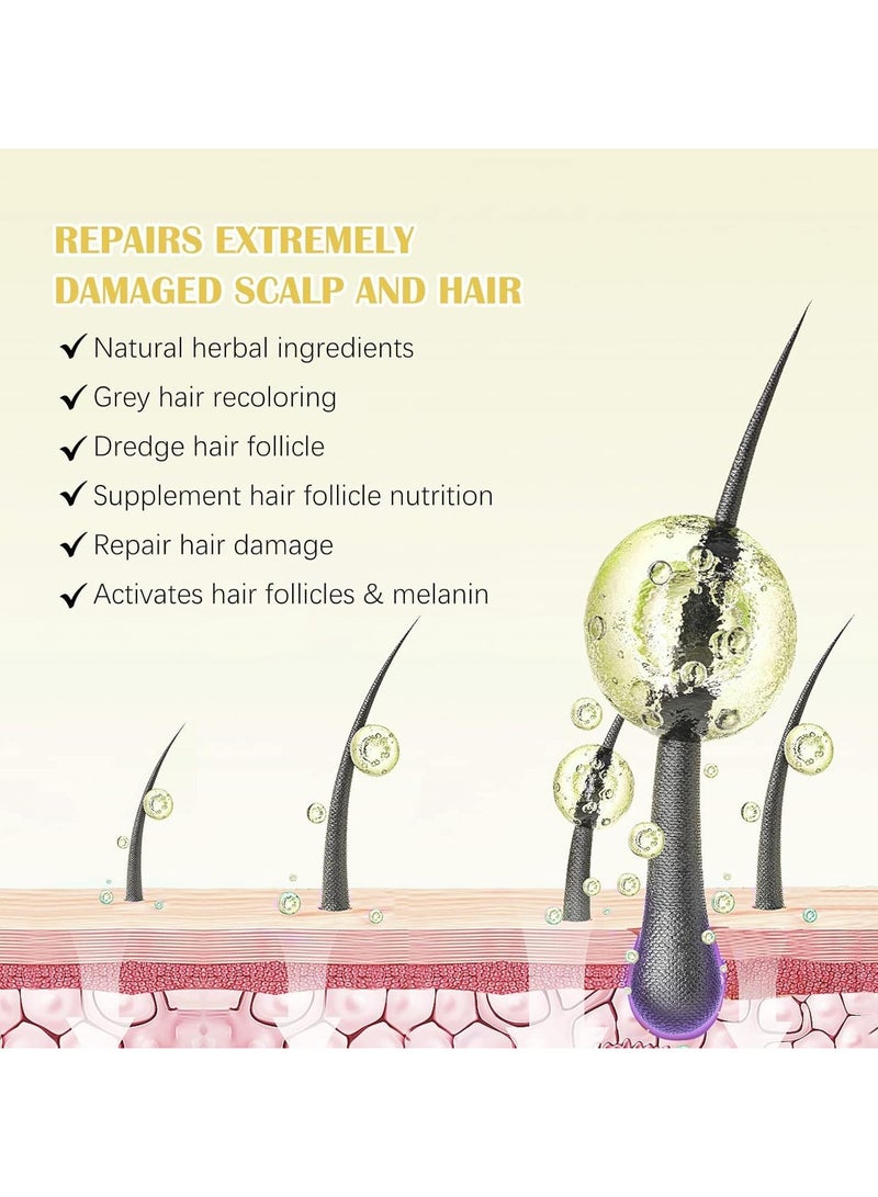 سيفودون 5٪ Minoxidil نمو الشعر مصل مجموعة مع Derma Roller,Minoxidil للرجال والنساء الشعر اللحية,2.02 أوقية بيوتين إعادة نمو المصل العلاج للحصول على شعر أكثر سمكا وصحة - Image 4