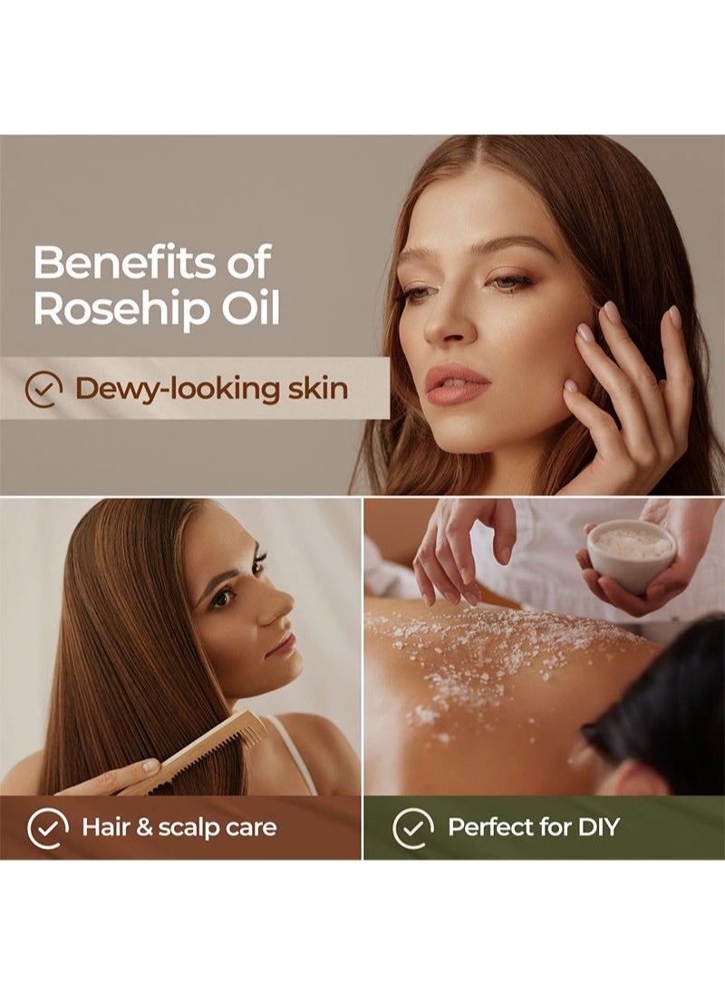 Mabox - 100% Pure Rosehip Oil - Cold Pressed and Unrefined - Non-Greasy Highly Absorbent - Use Daily - Nourishes, Moisturizes and Dramatically Reduces Fine Lines, Scars, Stretch Marks and Skin - Image 1