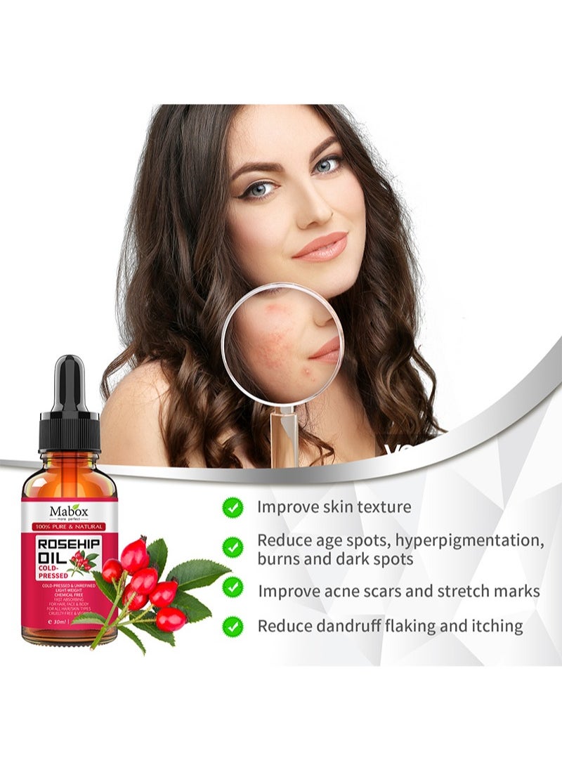 Mabox - 100% Pure Rosehip Oil - Cold Pressed and Unrefined - Non-Greasy Highly Absorbent - Use Daily - Nourishes, Moisturizes and Dramatically Reduces Fine Lines, Scars, Stretch Marks and Skin - Image 1