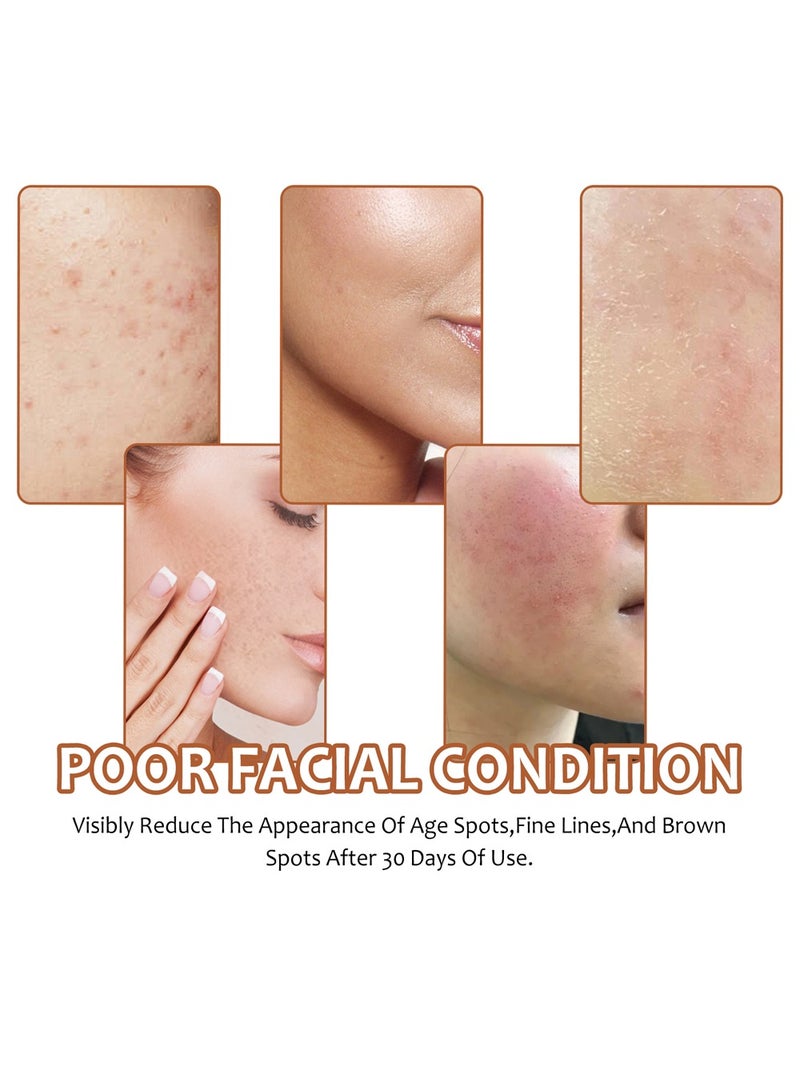 OUHOE Lemon Kojic Acid Turmeric Soap with Soap Box & Foaming Net Set - Vitamin C Turmeric Soap with  Foaming Net - Reduce Dark Spot for Face and Body - Image 5