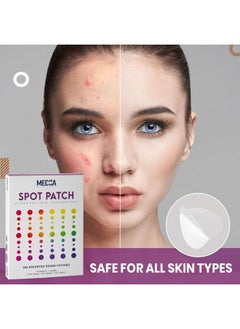 MEDca Acne Patches For Face Hydrocolloid Bandages (360 Count) Pimple Patch In 3 Universal Sizes Acne Spot Treatment Care For Face & Skin Spot Patch Conceals Zits Acne Reduces Pimples And Blackheads  - Image 3