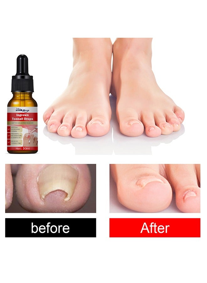 SOUTH MOON Ingrown Toenail Drops Serum 30ml, Ingrown Toenail Relief, Easy Trim Ingrown Toenail Tools, Toenail Fluid With Silicone Gel Toe Caps Essential Oil Diffuser, Ingrown Toenail Reliever and Softener Kit - Image 5