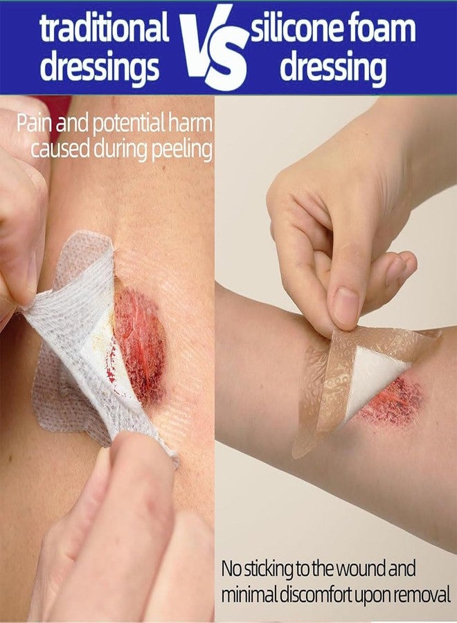 GoLashFun Self Adhesive Wound Dressing Bandage, Silicone Foam Dressing for Wound Care, Like Surgical, Burn, Good for Minimally Invasive Surgery Care (10pcs/Box (Skin Color, 4''X4'' - Image 3