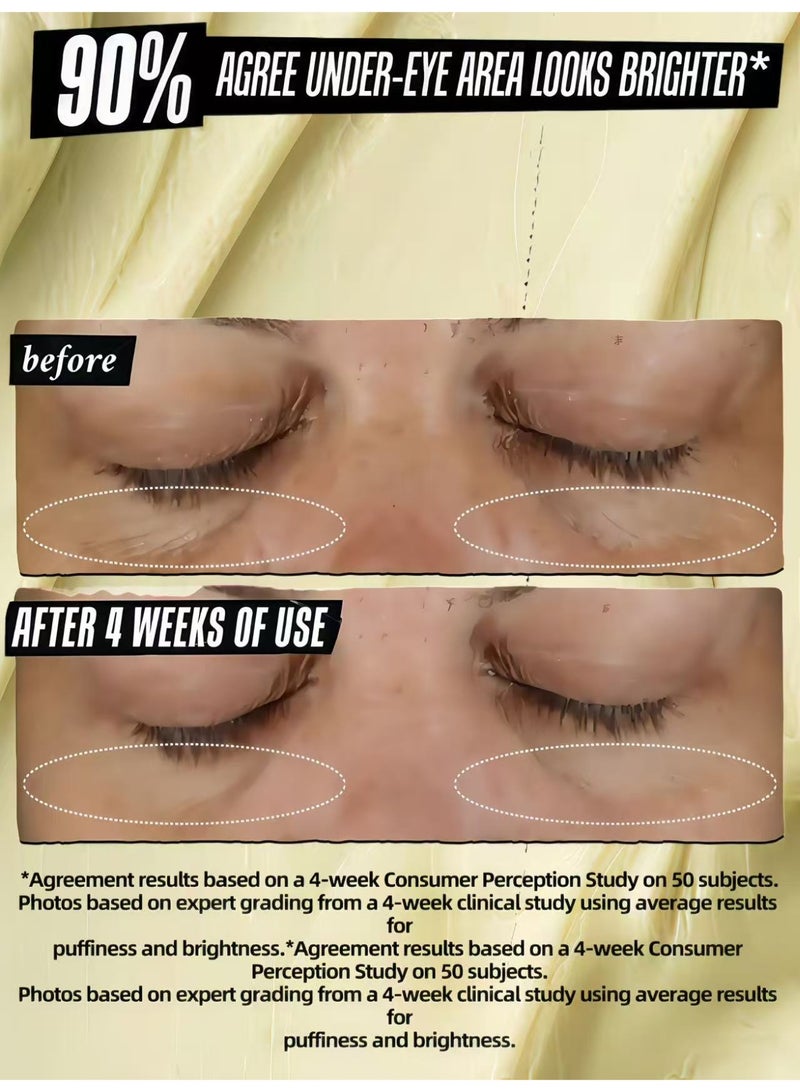 كييلز 2 Box Kiehl Avocado Cream Treatment - 14g | كريمة العيون ترطيب للدوائر المظلمة والعرض المنتفخ والرائع | مع زيت الأفوكادو وزبدة الشيا مع صيغة غذائية - Image 4