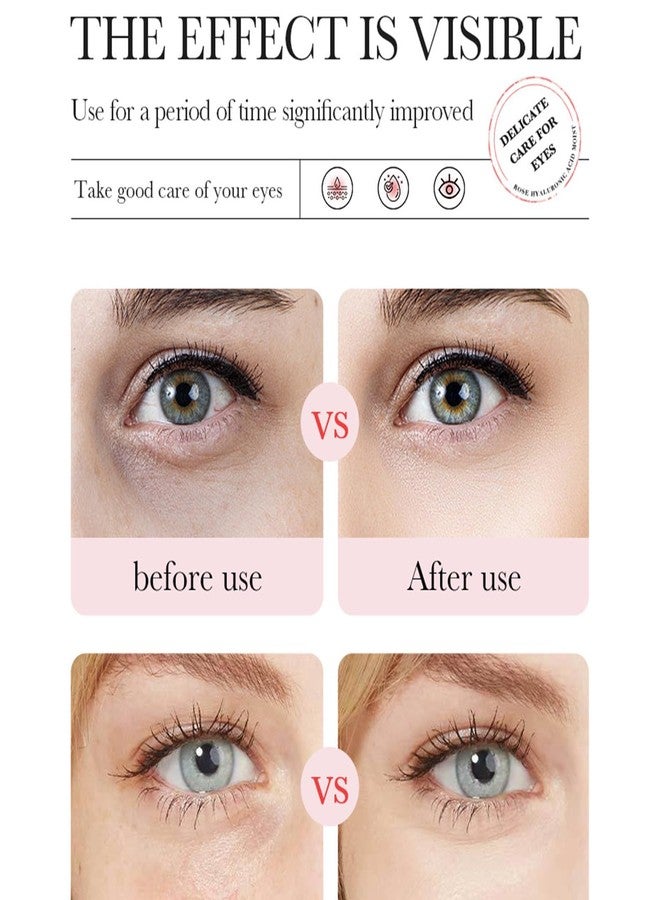 Eakroo Rose Eye Masks, 60 PCS Eye Patches for Puffy Eyes and Dark Circles, Hydrating Eye Mask Skincare, Eye Patch, Parches Para Ojeras, Under Eye Bags, Reduce Wrinkles and Fine Lines, Improve Eye Skin - Image 3