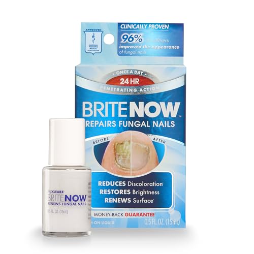 ProClearz Brite Now Nail Treatment Restores The Appearance Of Damaged  Discolored Nails PeelAway Technology Brightening  Smoothing Nail Repair 05 Ounce - Image 1