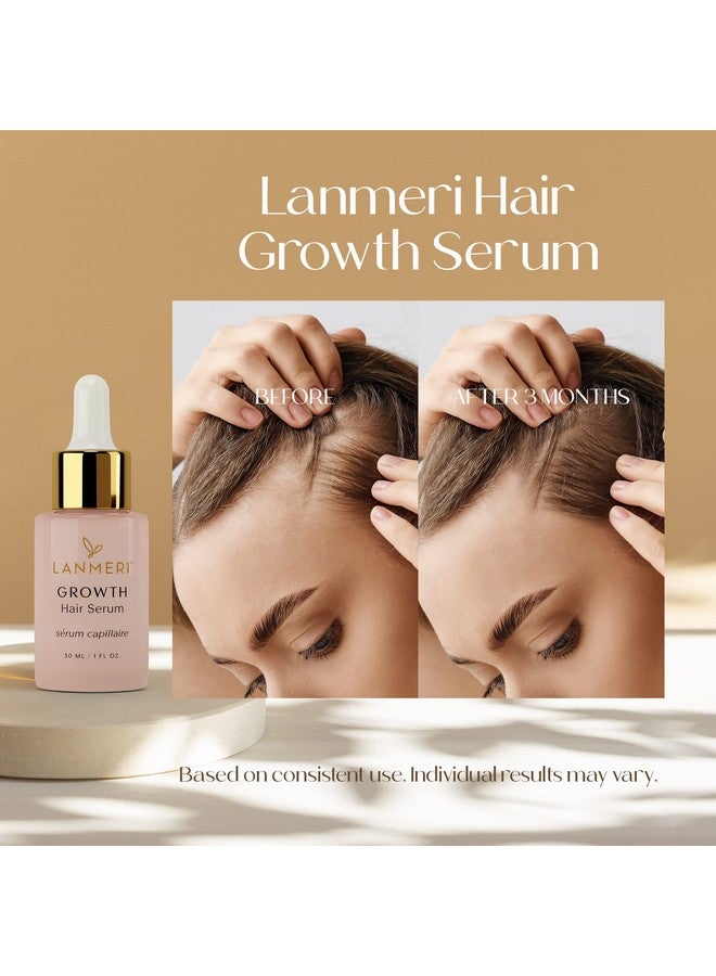 Lanmeri Vegan Hair Growth Serum Natural Hair Regrowth And Hair Loss Treatments For Women & Men Scalp Serum For Thinning Hair Fuller Thicker And Healthier Hair In 90 Days All Hair Types - Image 3