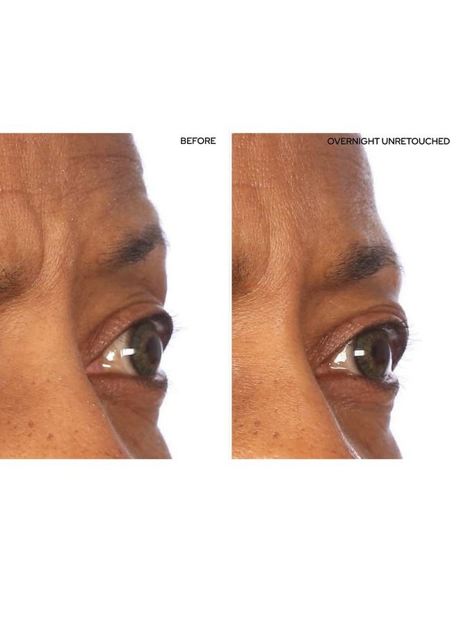 Sio Io Beauty Superlift Forehead Eye & Lip Antiwrinkle Silicone Patches Reduce Brow Smile And Under Eye Wrinkles Overnight  - Image 4