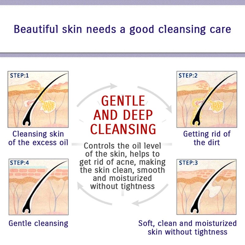 BIOAQUA Face Skin Care Acne Anti-Wrinkle Removal Cream Spots Scar Blemish Marks 100g - Image 5