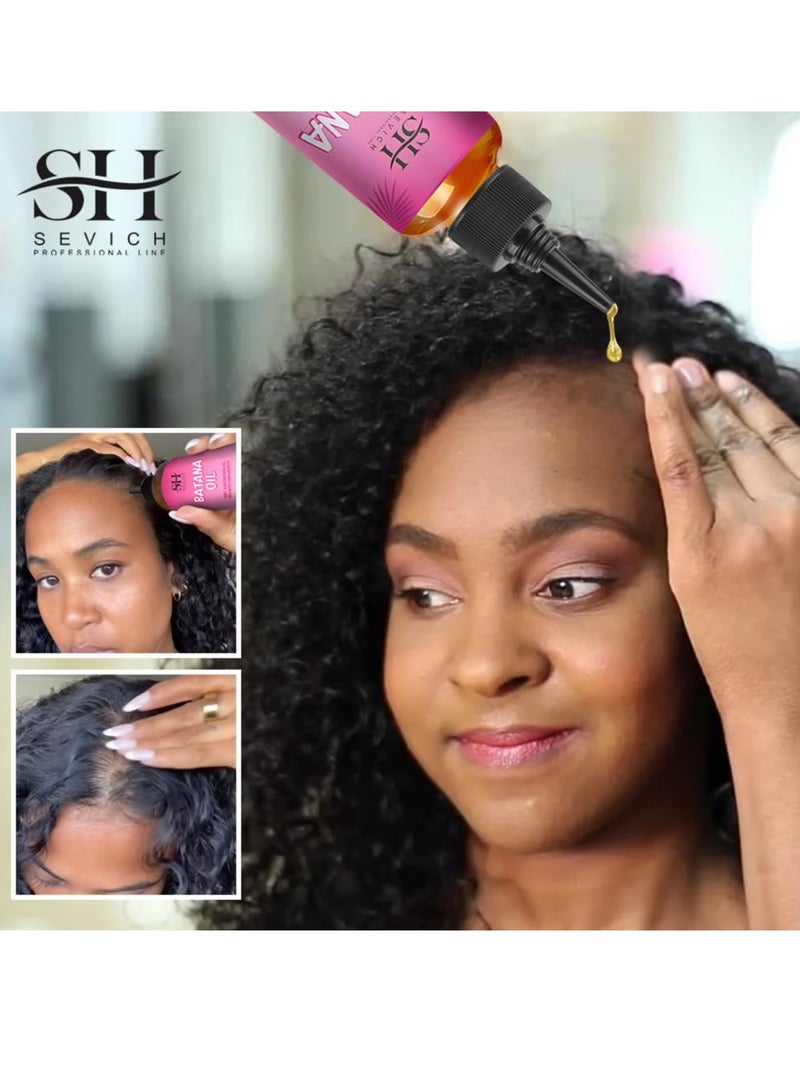 Sevich Natural Batana Oil for Hair Care Hair Conditioner Oil for Thin Hair Repair Damaged Hair Nourishes Thin Hair Scalp Skin and Loss Hair Growth Fit for All Hair Types Raw Batana Oil - Image 4