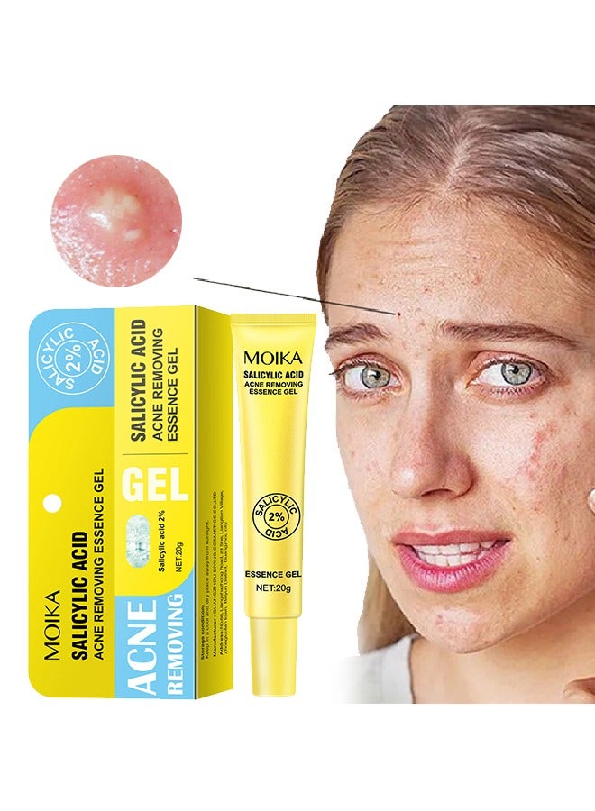 MOIKA Salicylic Acid Acne Removing Essence Gel, Acne Treatment Gel, Acne Spot Treatment for Face & Acne Dots, Natural Cystic Acne Treatment, For All Skin Types, Premium Acne Remover - 20g - Image 1