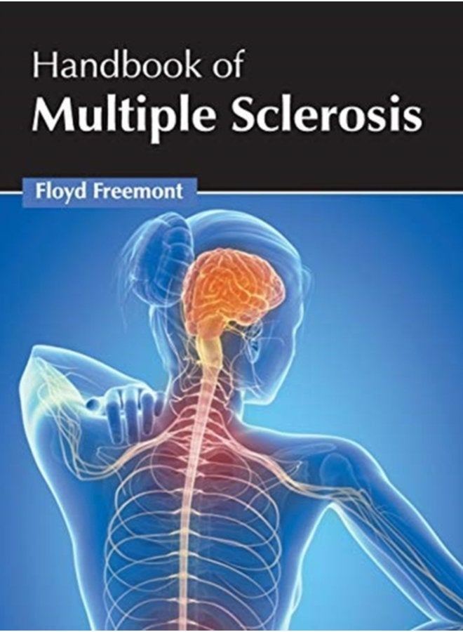 Handbook of Multiple Sclerosis - Hardback