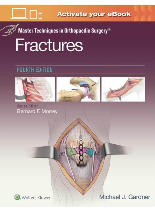 Master Techniques in Orthopaedic Surgery: Fractures 