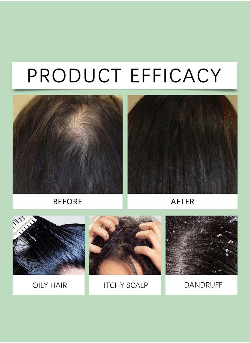 HOEGOA - Rosemary Scalp Scrub with Scalp Scrubber Set, Contains Rosemary, Peppermint Oil, and Petrel Ingredients Scalp Exfoliator Scrub, Scalp Cleanser for Relieve Scalp Itching, Exfoliate and Care for Scalp and Hair - Image 1
