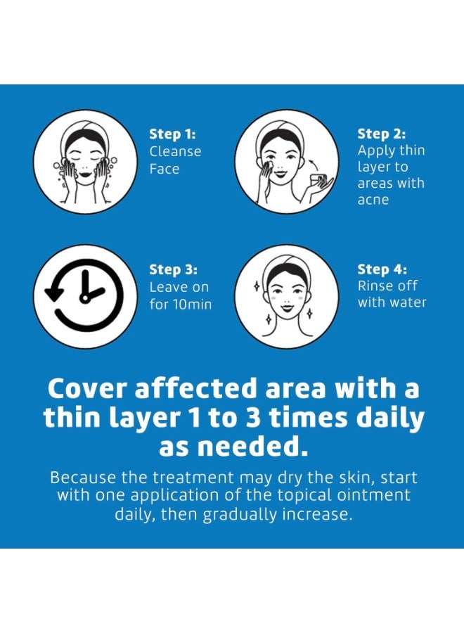 دي لا كروز مرهم الكبريت  علاج حب الشباب  قوة مضاعفة 6 جم - Image 5