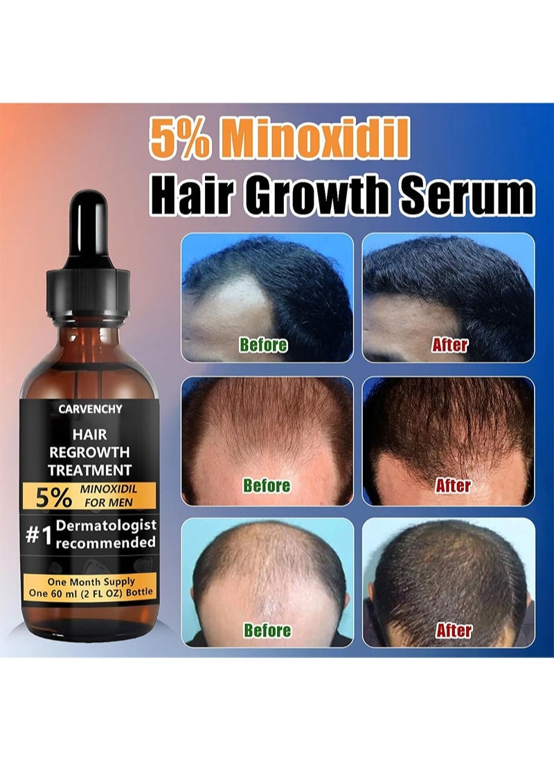 CARVENCHY - 5% Minoxidil Hair Regrowth and Beard Growth，Men's Extra Strength Hair Treatment- Extra Strength Topical Serum for Men's Scalp and Facial Hair Loss，Dermatologist Recommended - Image 1
