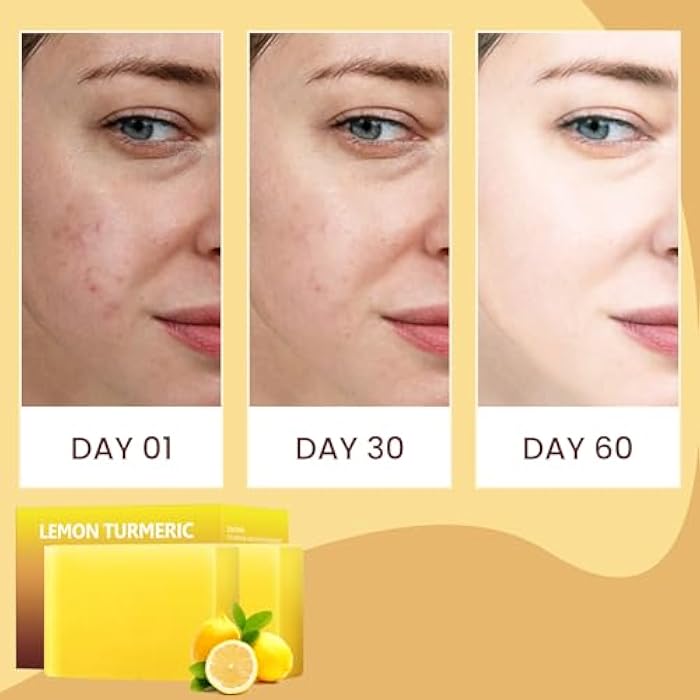 YAFUSIPE Lemon Turmeric Kojic Acid Soap Bar, Turmeric Soap for Face Body Hands, Deep Cleansing Natural Curcuma Bath Soaps Bar, Moisturizing Facial Cleanser Body Wash for All Skin Types Blemish 2 Bars - Image 2