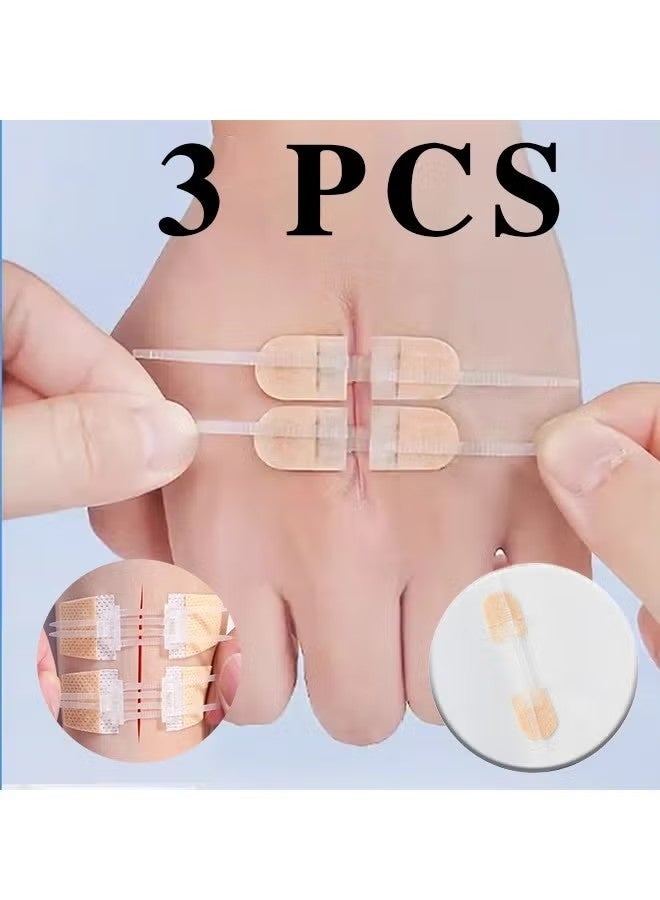 3 Pcs Zip Stitch Wound Closure Device Emergency Zipstitch Laceration Kit Bandages with sterile Strips Painless Laceration Repair Without Stitches Wound Care First Aid - Image 1