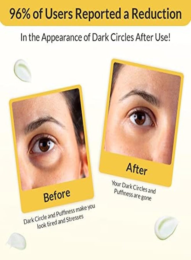 Eyecirque Under EYE Gel Serum - (60g) Twin pack for Dark Circles, Puffiness | 96% Users Reported a Reduction of Dark Circles - Image 3