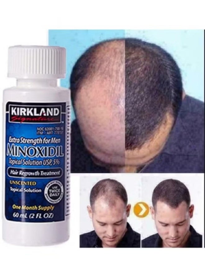 Kirkland Minoxidil 5% Extra Strength Hair Regrowth Treatment ， Minoxidil Hair Regrowth Treatment，2 bottles (60ml)-Minoxidil Topical Solution ﻿ - Image 3