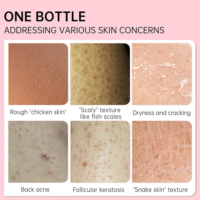 Grospe Skin Exfoliating Repair Cream, Chicken Skin Care Cream, Strawberry Legs Treatment Body Cream, Hydrating Moisturising Refreshing Skin Fragrance Repair Body Lotion 50g - Image 3