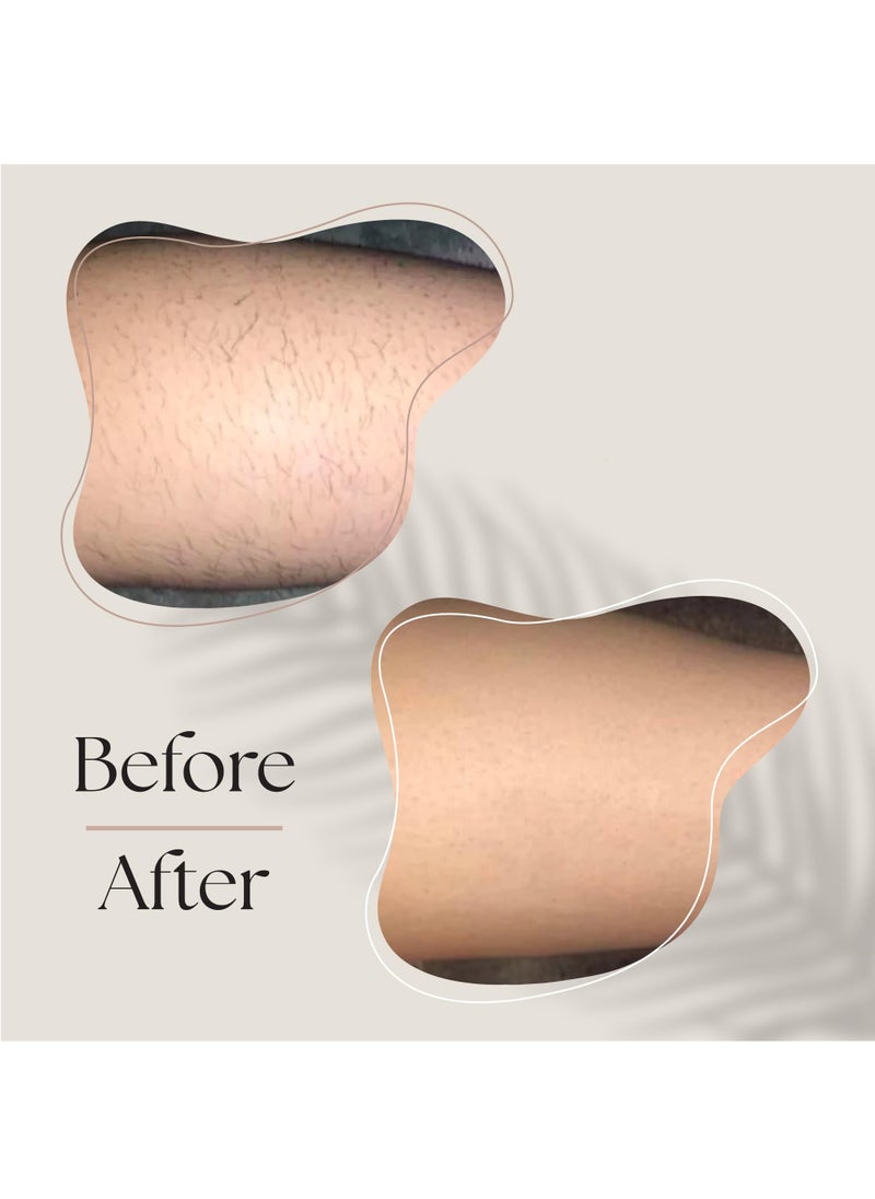 BORTONY IPL Intelligent Laser Hair Removal System for Long Lasting Results Pain-Free At Home Laser Hair Removal for Whole Body Treatment  - Image 2