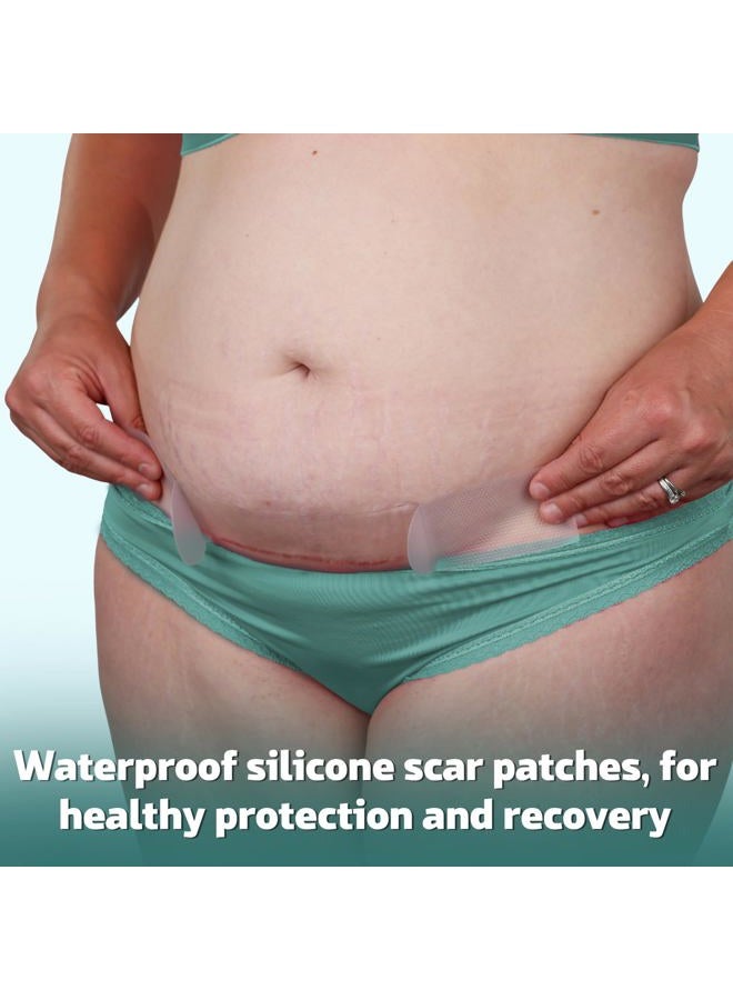 Mama & Wish ® C-Section Recovery Kit Must Haves - Postpartum Essentials 12-Piece Set with Belly Binder, No-Shower Wipes, Silicone Scar Patches, Peri Bottle, Underwear, Grip Socks & Toiletry Bag - Image 5