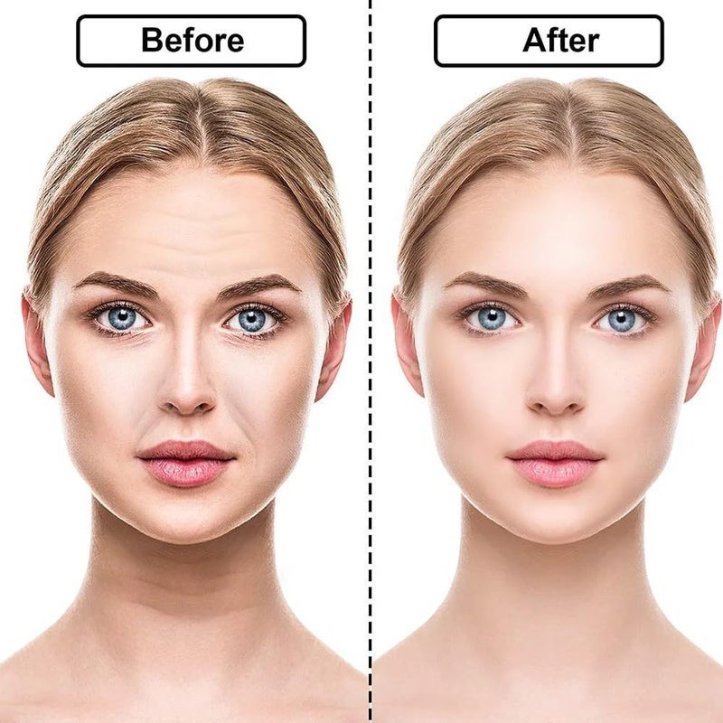16 Pcs Reusable Anti-Wrinkle Patches – Forehead, Neck & Eye Pads, Wrinkle Removal Stickers for Face, Skin Care & Beauty Health - Image 4