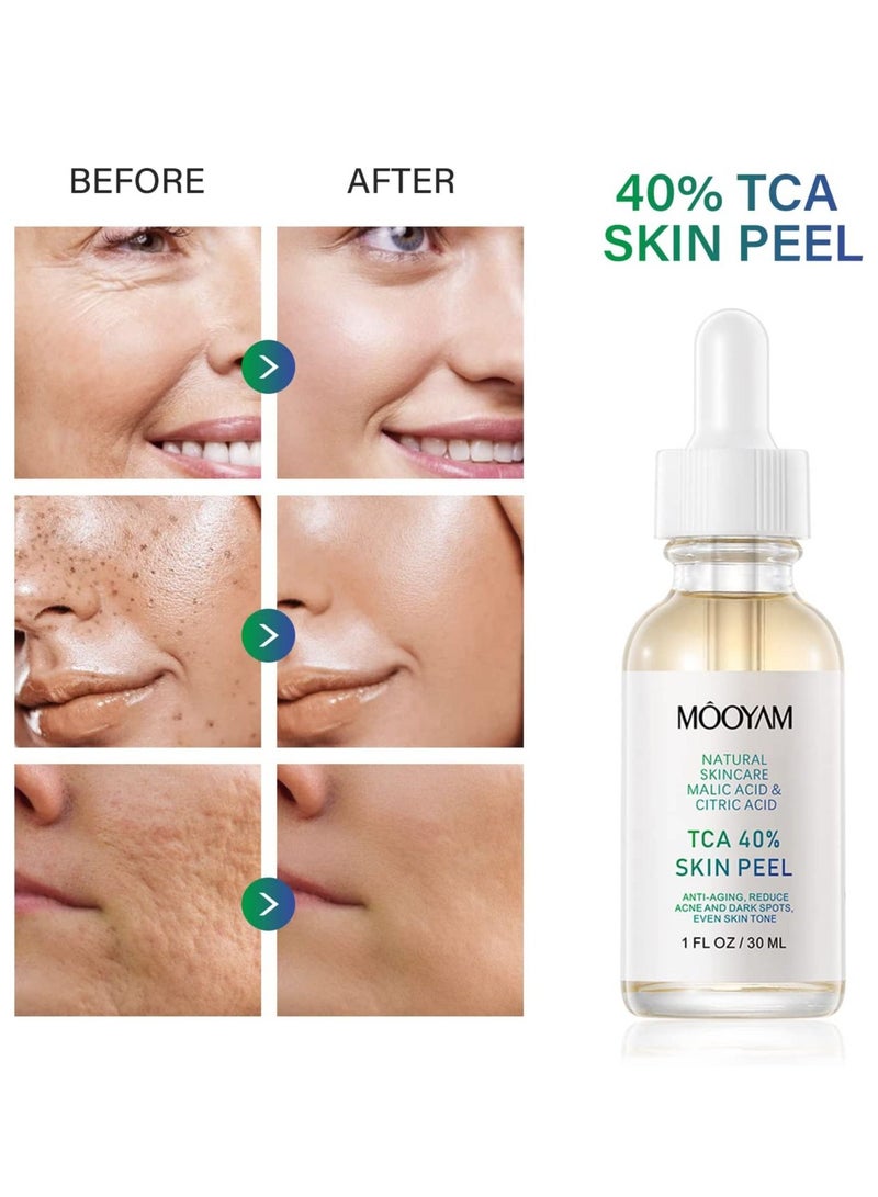 MOOYAM 40% Citric Acid Peeling Serum Chemical Peel for Face Peeling Solution Skin Peel Chemical Exfoliant for Face Exfoliating Facial Peel for Dark Skin Dark Spots Acne Spot 30ml - Image 3