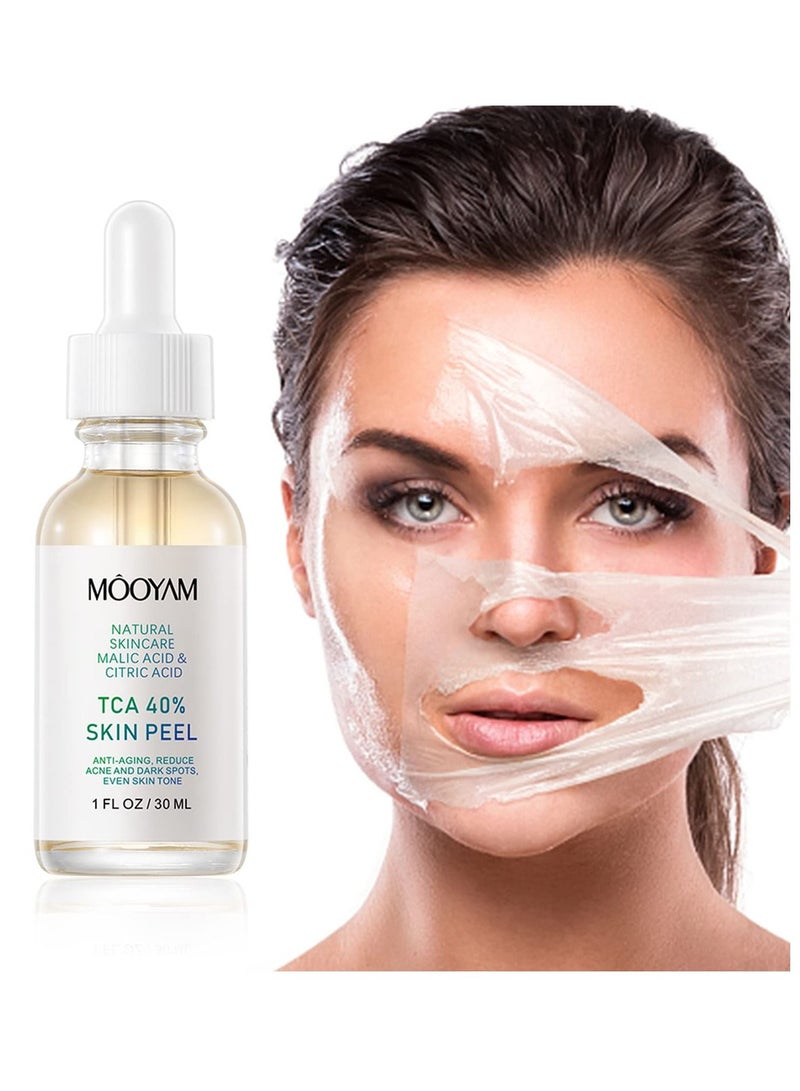 MOOYAM 40% Citric Acid Peeling Serum Chemical Peel for Face Peeling Solution Skin Peel Chemical Exfoliant for Face Exfoliating Facial Peel for Dark Skin Dark Spots Acne Spot 30ml - Image 2