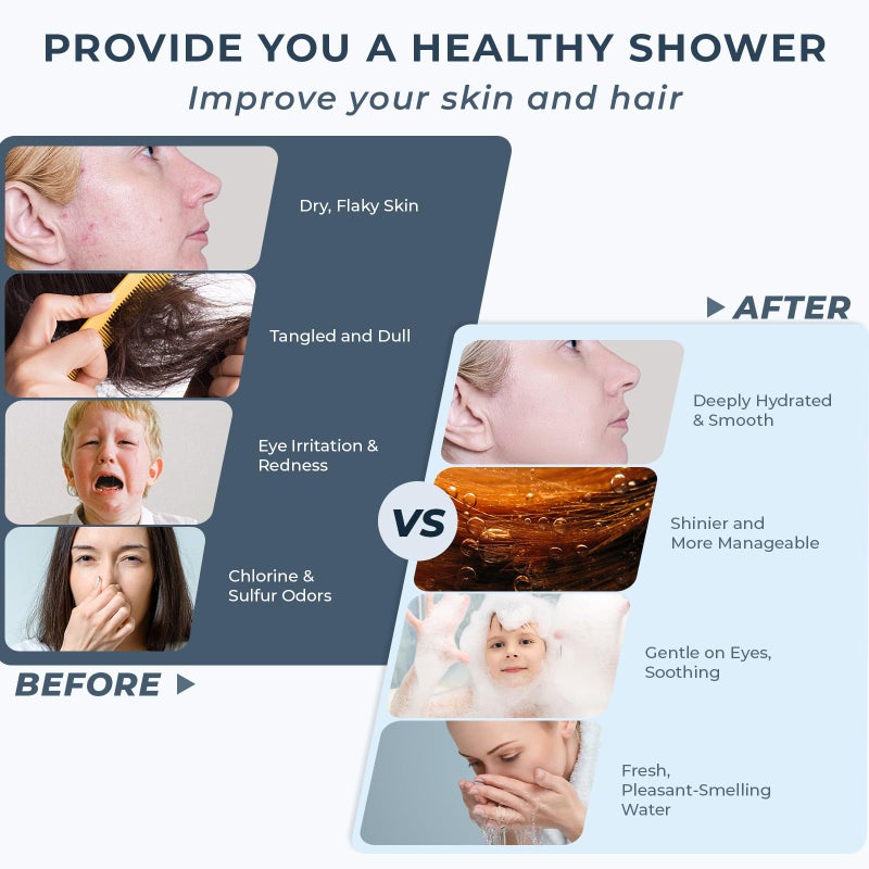 Ryamen 2026 Magnetic Filtered Shower Head with Handheldâ€“ High Pressure Showerhead with Power Wash Mode, Chlorine Removal, Massage Brush, Pressure Adjustable, One-Touch Pause & Stainless Steel Hose - Image 4