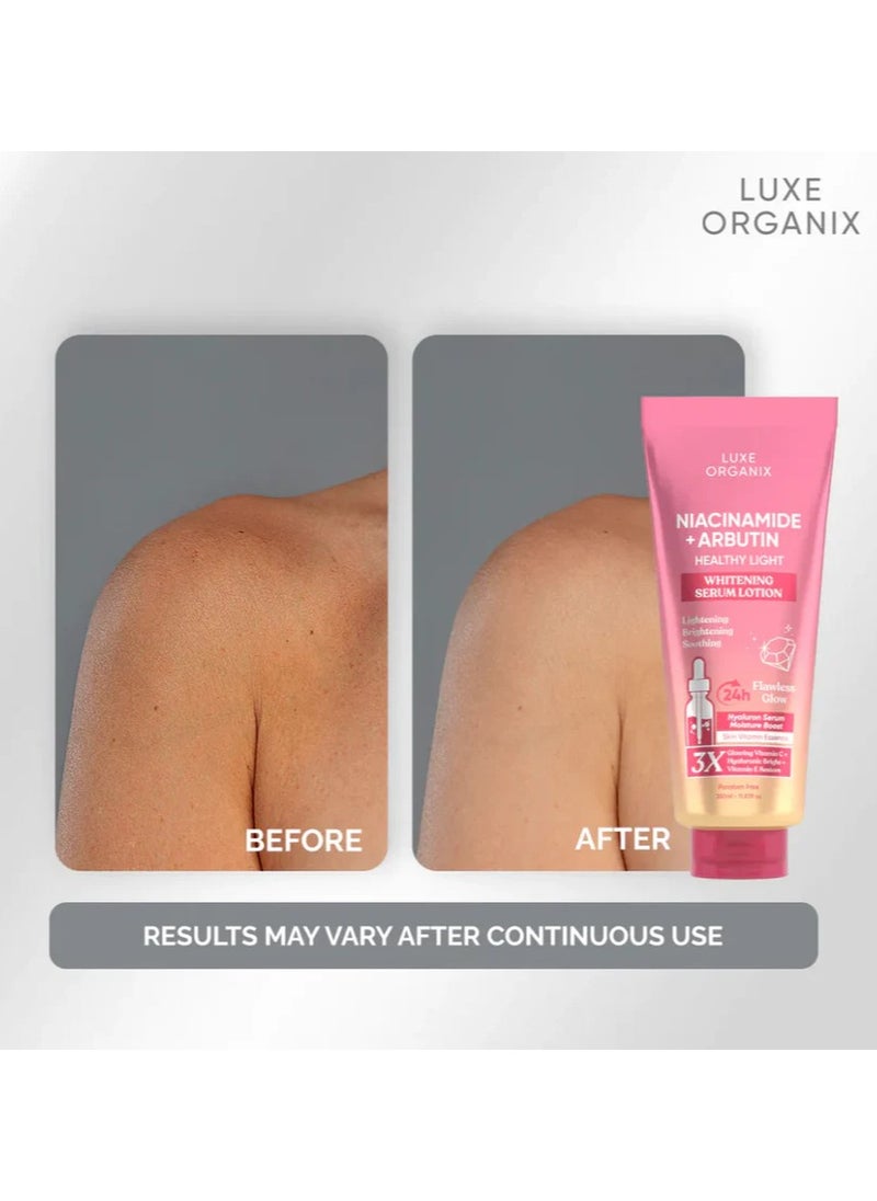 LUXE ORGANIX Niacinamide + Arbutin Helthy Light Whitening Serum Lotion  - Image 3