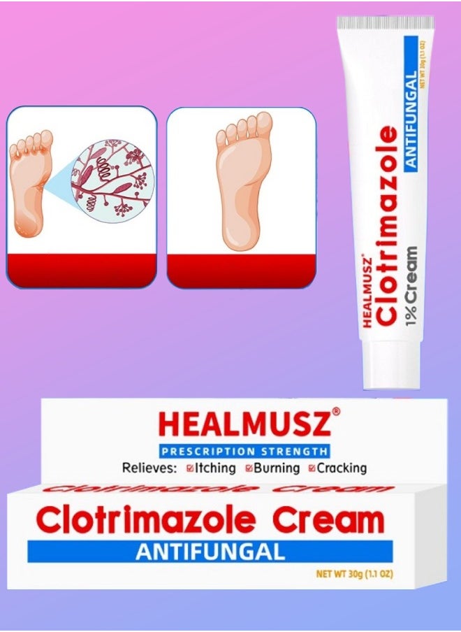 HEALMUSZ - Clotrimazole Cream Athlete Foot Cream Jock Itch and Ringworm Cream Relieve Itching Burning Cracking & Scaling Clotrimazole Antifungal Cream Body Cream Athletes Foot Ointment  Anti Fungal Cream 30ml - Image 1