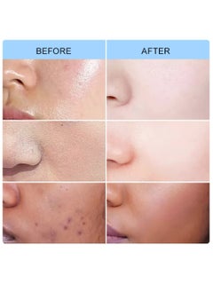 AuQuest 50g Anti UV Facial Moisturizing Sunscreen Cream SPF 30+ PA+++ Sunscreen Cream with Hyaluronic Acid for Moisturizing Nourishing Strengthening UVA UVB Protection Waterproof and Sweatproof Moisturizing Cream Facial cream  - Image 2