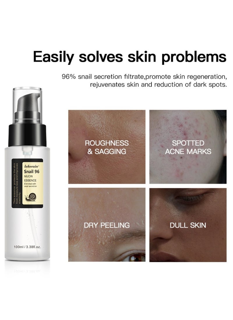 lakerain - 100 مل متطور الحلزون 96 Mucin Power Essence مضاد للشيخوخة الحلزون Mucin Essence مرطب ترطيب مكثف للخطوط الدقيقة، مرونة الجلد، الحبر، الخطوط الدقيقة، علاج البقع، كريم إصلاح الوجه - Image 1