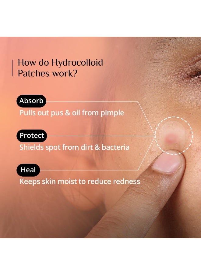 Carmesi Pimple Patch For Face | 36 Hydrocolloid Pimple Patches | 2% w/w Salicylic Acid, Neem, Cica | Helps Reduce Pimples, Redness & Irritation | Absorbs Excess Oil | Safe for All Skin Types - Image 2