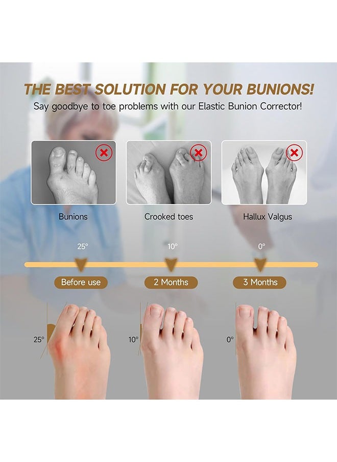 Generic - 1 Pair Bunion Corrector Relief Sleeve for Women & Men, Big Toe Gel Bunion Corrector Separator Straightener for Day/Night Support, Hallux Valgus Pain Relief, Bunion Socks - Image 1