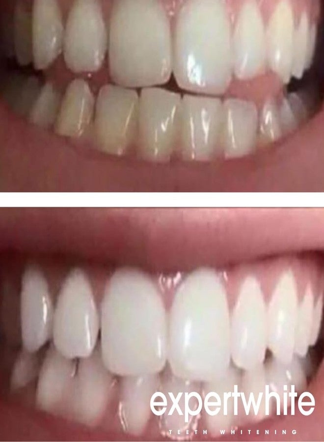 Expertwhite 44% Teeth Whitening Gel - Refills for Trays – Professional Strength Carbamide Petoxide Syringes, 4 × 3cc, 15-Minute Treatment, Gels Only (No Trays - Image 4