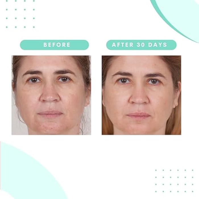 Serious Skincare - Glycolic Acid Resurfacing Face Pads for Smoother Skin - Exfoliates Dead Skin Cells - Pre-Soaked Cotton Disc - Vitamin E, ALoe -2 Pack (60 Pads Each) - Image 4