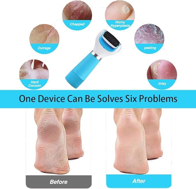 Electric Foot File Callus Remover - Foot Scrub pedicure kit Tools, Rechargeable Electronic Feet heel Scrubber Scraper Trimmers Rasp Exfoliator Portable Care Perfect for Dead Skin - Image 2