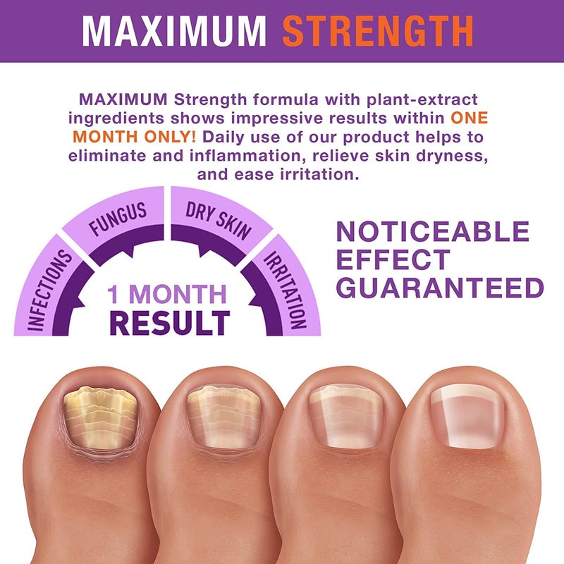 PureSkin PURE SKIN Toenail Fungus Treatment For Toenail & Finernails, Toe Nail Fungus Treatment Extra Strength, Effective Fungal Nail Treatment for Finger & Toenail -1 OZ - Image 5