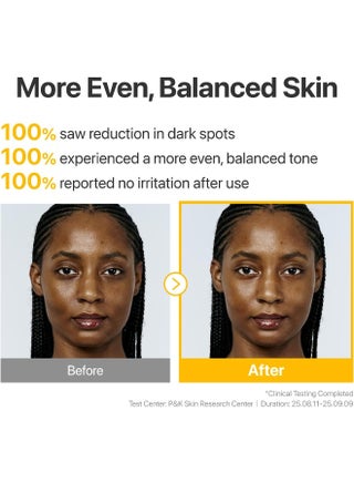 No.5 Serum | Glutathione TXA Advanced Dark Spot Ampoule Concentrate | Tranexamic Acid, Niacinamide | Hyperpigmentation| Suitable for Sensitive Skin, Korean Skincare | 10.7g - view 5