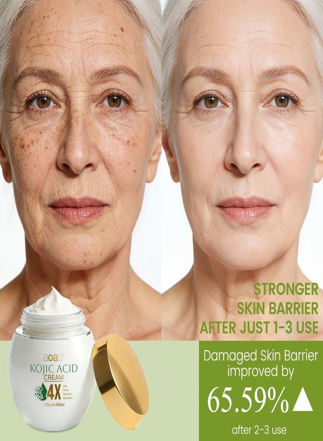 AOAO Kojic Acid Cream, Hydrates Deeply with Multi-Tasking Niacinamide, Centella & Arbutin for Skin Soothing & Daily Nourishing, Face & Neck Moisturizer for Uneven Skin Tone, Paraben-Free, 130g - Image 2