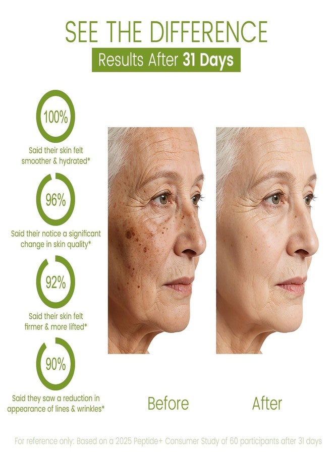 AOAO Kojic Acid Cream, Hydrates Deeply with Multi-Tasking Niacinamide, Centella & Arbutin for Skin Soothing & Daily Nourishing, Face & Neck Moisturizer for Uneven Skin Tone, Paraben-Free, 130g - Image 5