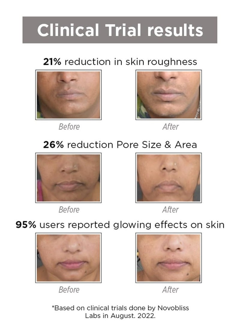 SkinQ Niacinamide and Vitamin C Face Mask AHA Based for Glowing Skin Reduces Tan Fights Pigmentation Instant Glow in 15 Minutes for All Skin Types Women and Men 30g - Image 2
